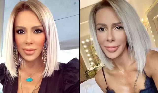 Sosyetik güzel Hande Demir'in darp edildiği iddia edilmişti: İlk kez konuştu