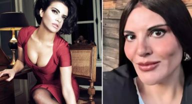 Göksel, estetik iddialarına video ile yanıt verdi: Fotoğraftaki kişiyi tanımıyorum